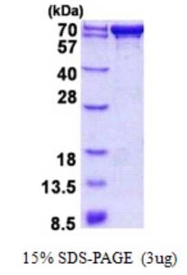 SDS-PAGE: Recombinant Human PDZK1 His Protein [NBP2-23318]