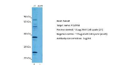 Western Blot: PDZRN3 Antibody [NBP2-88028]