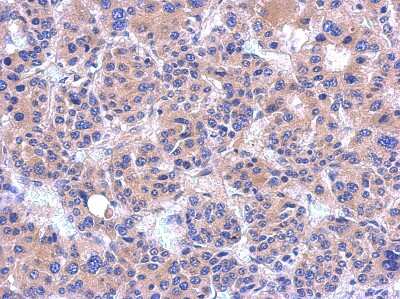 Immunohistochemistry-Paraffin: PDZRN4 Antibody [NBP2-19762]