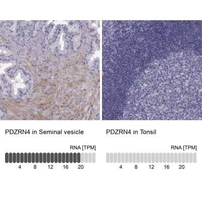 Immunohistochemistry-Paraffin: PDZRN4 Antibody [NBP2-62606]