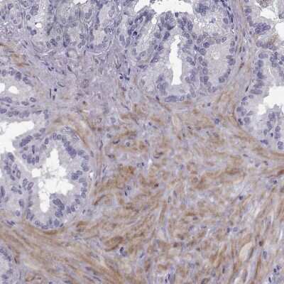 Immunohistochemistry-Paraffin: PDZRN4 Antibody [NBP2-62606]