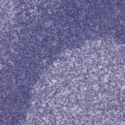 Immunohistochemistry-Paraffin: PDZRN4 Antibody [NBP2-62606]