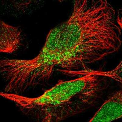 Immunocytochemistry/ Immunofluorescence: PEA-15 Antibody [NBP1-81732]