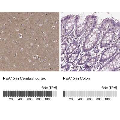 Immunohistochemistry-Paraffin: PEA-15 Antibody [NBP2-62670]