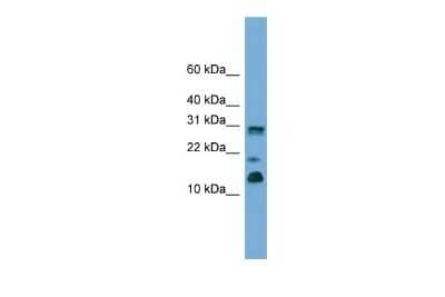 Western Blot: PEA-15 Antibody [NBP2-88031]