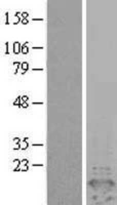 Western Blot: PEA-15 Overexpression Lysate [NBL1-14273]