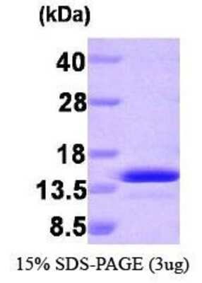 SDS-PAGE: Recombinant Human PEA-15 Protein [NBP1-30247]