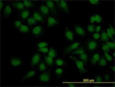 Immunocytochemistry/ Immunofluorescence: PEAK1 Antibody (3E7) [H00079834-M02]