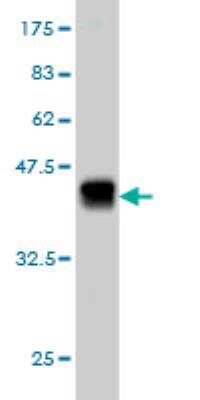 Western Blot: PEAK1 Antibody (3G6) [H00079834-M03]