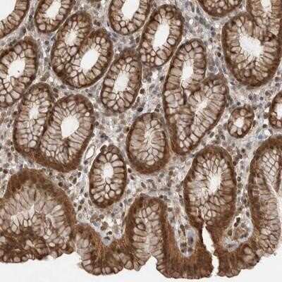 Immunohistochemistry-Paraffin: PEAK1 Antibody [NBP1-91052]