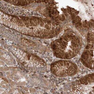 Immunohistochemistry-Paraffin: PEAK1 Antibody [NBP1-91053]