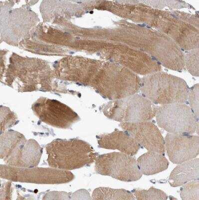 Immunohistochemistry-Paraffin: PEBP4 Antibody [NBP1-84404]