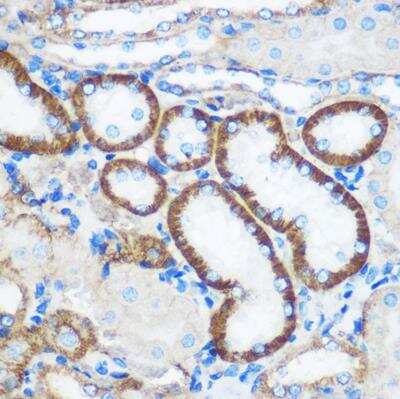 Immunohistochemistry-Paraffin: PEBP4 Antibody - Azide and BSA Free [NBP2-94384]