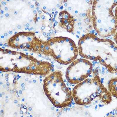 Immunohistochemistry-Paraffin: PEBP4 Antibody - Azide and BSA Free [NBP2-94384]