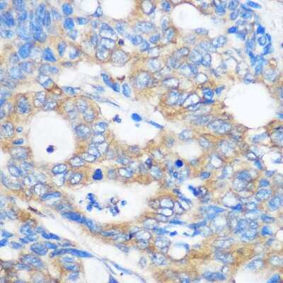 Immunohistochemistry-Paraffin: PEBP4 Antibody - Azide and BSA Free [NBP2-94384]