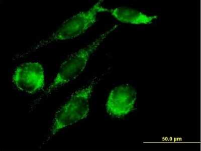 Immunocytochemistry/ Immunofluorescence: PECI Antibody [H00010455-B01P]