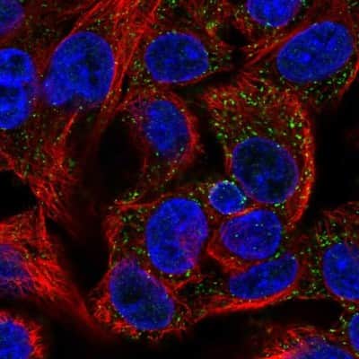 Immunocytochemistry/ Immunofluorescence: PECI Antibody [NBP2-48614]