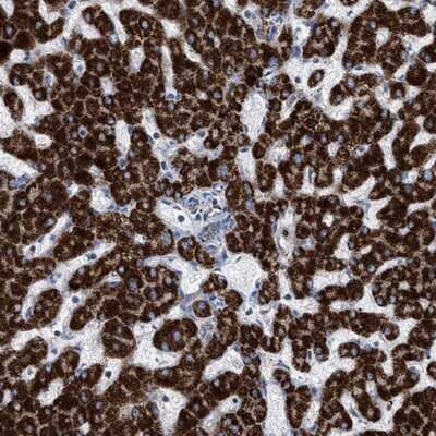 Immunohistochemistry-Paraffin: PECI Antibody [NBP1-89283]