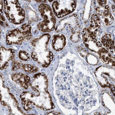 Immunohistochemistry-Paraffin: PECI Antibody [NBP1-89283]