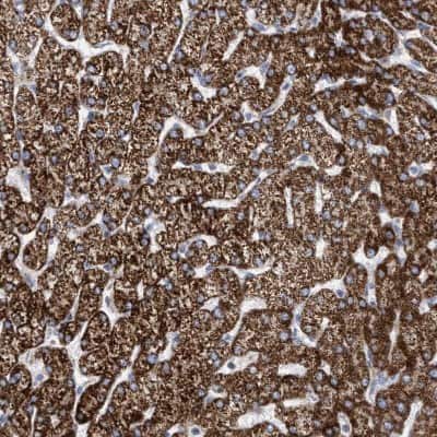Immunohistochemistry-Paraffin: PECI Antibody [NBP1-89283]