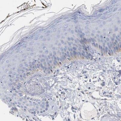 Immunohistochemistry-Paraffin: PECI Antibody [NBP1-89283]