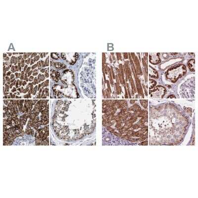 Immunohistochemistry-Paraffin: PECI Antibody [NBP1-89283]
