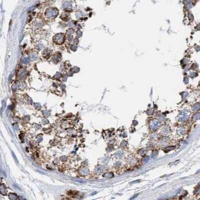 Immunohistochemistry-Paraffin: PECI Antibody [NBP1-89283]