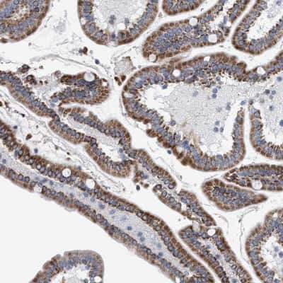 Immunohistochemistry-Paraffin: PECI Antibody [NBP1-89283]