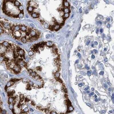 Immunohistochemistry-Paraffin: PECI Antibody [NBP1-89283]