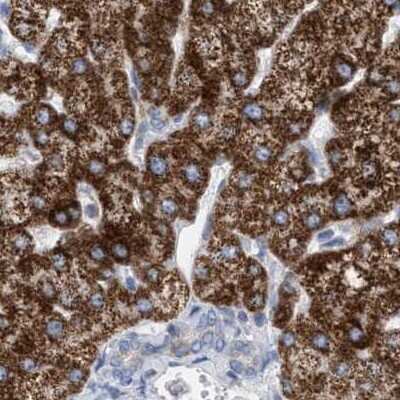 Immunohistochemistry-Paraffin: PECI Antibody [NBP1-89283]