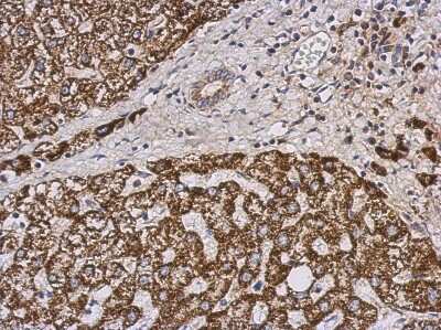 Immunohistochemistry-Paraffin: PECI Antibody [NBP2-19765]