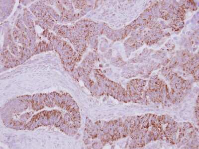 Immunohistochemistry-Paraffin: PECI Antibody [NBP2-19766]