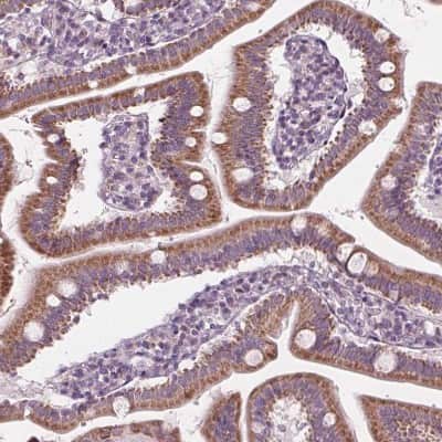 Immunohistochemistry-Paraffin: PECI Antibody [NBP2-48614]