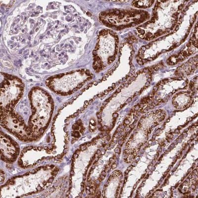 Immunohistochemistry-Paraffin: PECI Antibody [NBP2-48614]