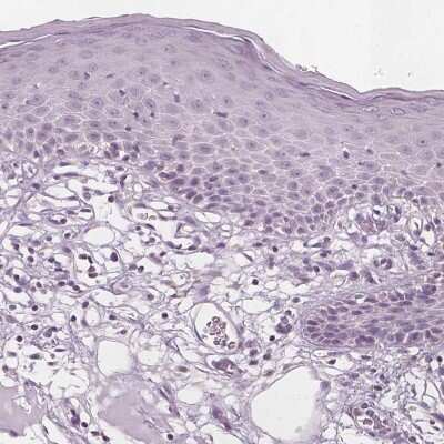 Immunohistochemistry-Paraffin: PECI Antibody [NBP2-48614]