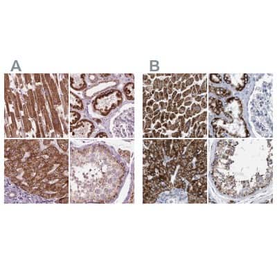 Immunohistochemistry-Paraffin: PECI Antibody [NBP2-48614]