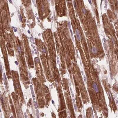 Immunohistochemistry-Paraffin: PECI Antibody [NBP2-48614]