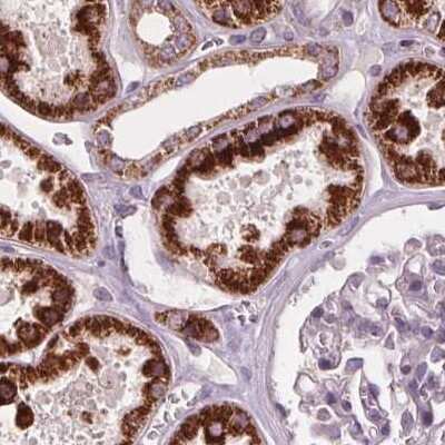 Immunohistochemistry-Paraffin: PECI Antibody [NBP2-48614]