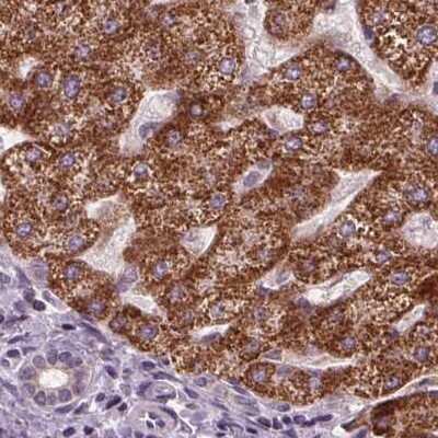Immunohistochemistry-Paraffin: PECI Antibody [NBP2-48614]