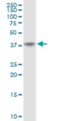 Western Blot: PECI Antibody [H00010455-B01P]