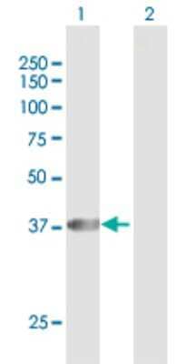 Western Blot: PECI Antibody [H00010455-D01P]