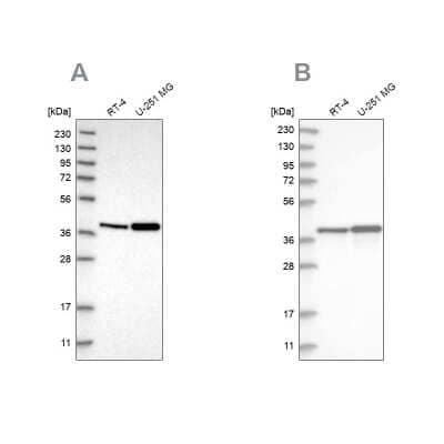 Western Blot: PECI Antibody [NBP1-89283]