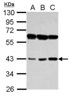 Western Blot: PECI Antibody [NBP2-19765]