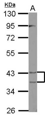 Western Blot: PECI Antibody [NBP2-19766]