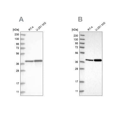 Western Blot: PECI Antibody [NBP2-48614]