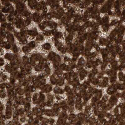 Immunohistochemistry-Paraffin: PECR Antibody [NBP1-83198]