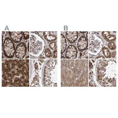 Immunohistochemistry-Paraffin: PECR Antibody [NBP1-83198]