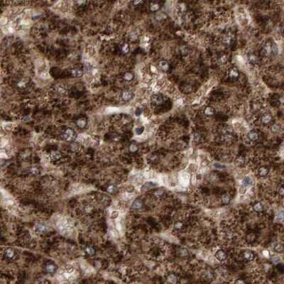 Immunohistochemistry-Paraffin: PECR Antibody [NBP1-83198]