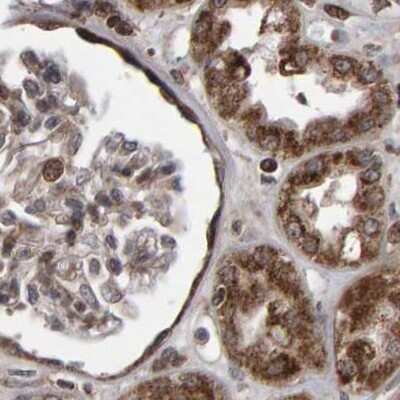 Immunohistochemistry-Paraffin: PECR Antibody [NBP1-83198]