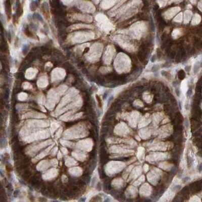 Immunohistochemistry-Paraffin: PECR Antibody [NBP1-83198]